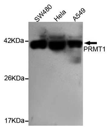 Western blot detection of PRMT1 in Hela,A549 and SW480 cell lysates using PRMT1 mouse mAb (1:1000 diluted).Predicted band size:42KDa.Observed band size:42KDa.