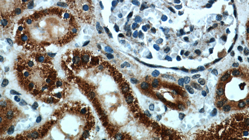 Immunohistochemical of paraffin-embedded human kidney using Catalog No:116577(UMOD antibody) at dilution of 1:50 (under 40x lens)