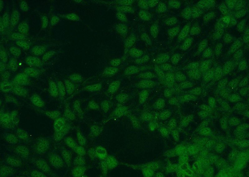 Immunofluorescent analysis of HEK-293 cells using Catalog No:113357(NUDT16 Antibody) at dilution of 1:50 and Alexa Fluor 488-congugated AffiniPure Goat Anti-Rabbit IgG(H+L)