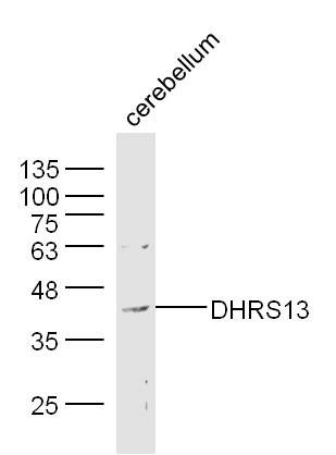 Fig1: Sample: Cerebellum (Mouse) Lysate at 40 ug; Primary: Anti-DHRS13 at 1/300 dilution; Secondary: IRDye800CW Goat Anti-Rabbit IgG at 1/20000 dilution; Predicted band size: 38 kD; Observed band size: 38 kD