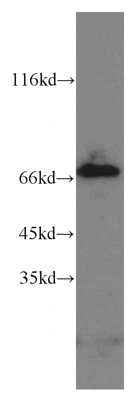 mouse brain tissue were subjected to SDS PAGE followed by western blot with Catalog No:109552(CREBZF antibody) at dilution of 1:100