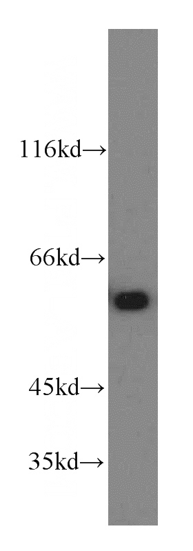 HeLa cells were subjected to SDS PAGE followed by western blot with Catalog No:109085(CCT6A-Specific antibody) at dilution of 1:100