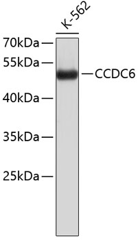 Western blot - CCDC6 Polyclonal Antibody 