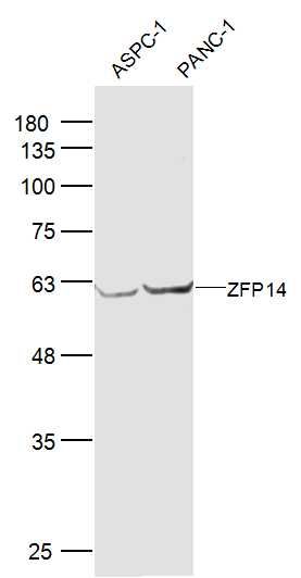 Fig1: Sample:; ASPC-1(Human) Cell Lysate at 40 ug; PANC-1(Human) Cell Lysate at 40 ug; Primary: Anti-ZFP14 at 1/300 dilution; Secondary: IRDye800CW Goat Anti-Rabbit IgG at 1/20000 dilution; Predicted band size: 63 kD; Observed band size: 63 kD