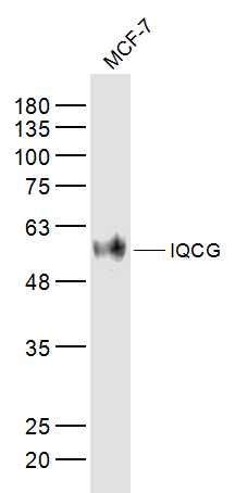 Fig1: Sample:; MCF-7(Human) Cell Lysate at 40 ug; Primary: Anti-IQCG at 1/300 dilution; Secondary: IRDye800CW Goat Anti-Rabbit IgG at 1/20000 dilution; Predicted band size: 52 kD; Observed band size: 52 kD