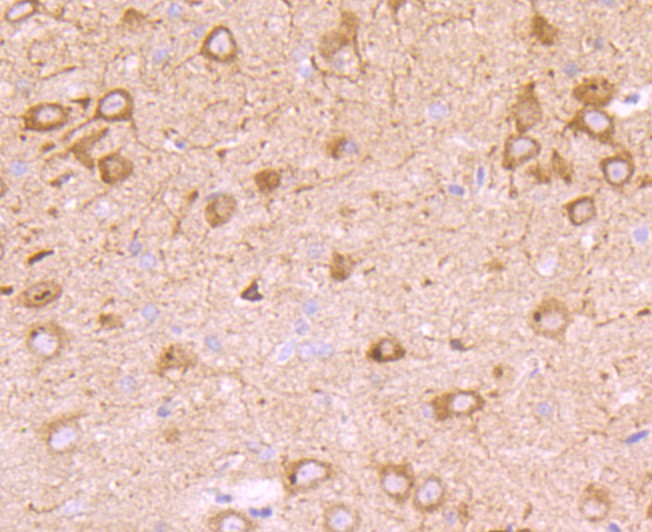 Fig3:; Immunohistochemical analysis of paraffin-embedded rat brain tissue using anti-PMP22 antibody. The section was pre-treated using heat mediated antigen retrieval with Tris-EDTA buffer (pH 8.0-8.4) for 20 minutes.The tissues were blocked in 5% BSA for 30 minutes at room temperature, washed with ddH; 2; O and PBS, and then probed with the primary antibody ( 1/50) for 30 minutes at room temperature. The detection was performed using an HRP conjugated compact polymer system. DAB was used as the chromogen. Tissues were counterstained with hematoxylin and mounted with DPX.