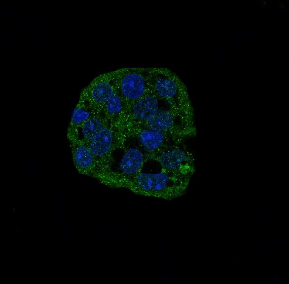 Immunofluorescent analysis of HepG2 cells, using active Caspase-3 Antibody .