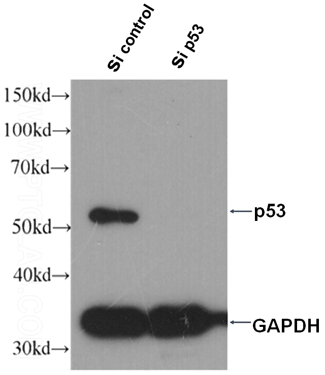 WB result of p53 antibody (Catalog No:107446, 1:1000) with sh-control and sh-p53 transfected A431 cells.
