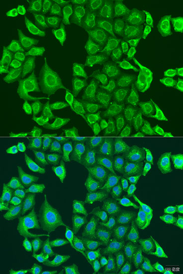 Immunofluorescence - PDK2 Polyclonal Antibody 