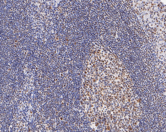 Fig2:; Immunohistochemical analysis of paraffin-embedded human tonsil tissue using anti-GATAD2A antibody. The section was pre-treated using heat mediated antigen retrieval with sodium citrate buffer (pH 6.0) for 20 minutes. The tissues were blocked in 5% BSA for 30 minutes at room temperature, washed with ddH; 2; O and PBS, and then probed with the primary antibody ( 1/200) for 30 minutes at room temperature. The detection was performed using an HRP conjugated compact polymer system. DAB was used as the chromogen. Tissues were counterstained with hematoxylin and mounted with DPX.