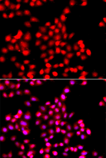 Immunofluorescence - TTBK2 Polyclonal Antibody 