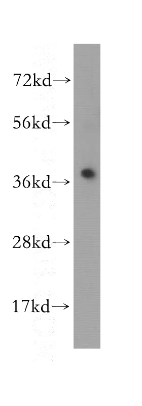 human kidney tissue were subjected to SDS PAGE followed by western blot with Catalog No:112649(MAP2K6 antibody) at dilution of 1:500