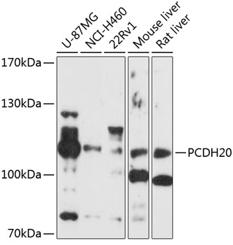 Western blot - PCDH20 Polyclonal Antibody 