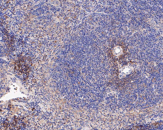 Fig5:; Immunohistochemical analysis of paraffin-embedded mouse spleen tissue using anti-IL18 binding protein antibody. The section was pre-treated using heat mediated antigen retrieval with Tris-EDTA buffer (pH 8.0-8.4) for 20 minutes.The tissues were blocked in 5% BSA for 30 minutes at room temperature, washed with ddH; 2; O and PBS, and then probed with the primary antibody ( 1/200) for 30 minutes at room temperature. The detection was performed using an HRP conjugated compact polymer system. DAB was used as the chromogen. Tissues were counterstained with hematoxylin and mounted with DPX.