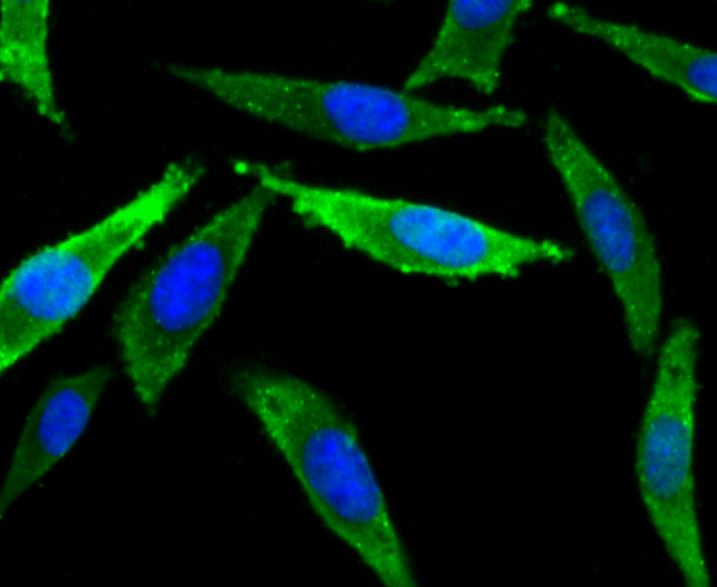 Fig1: ICC staining NaV1.7 in SH-SY5Y cells (green). The nuclear counter stain is DAPI (blue). Cells were fixed in paraformaldehyde, permeabilised with 0.25% Triton X100/PBS.