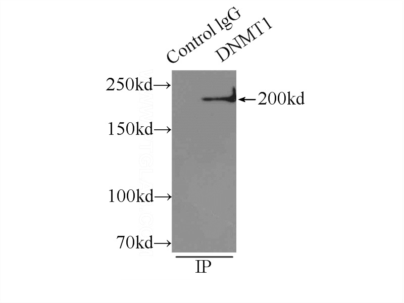 IP Result of anti-DNMT1 (IP:Catalog No:109966, 5ug; Detection:Catalog No:109966 1:500) with HEK-293 cells lysate 2500ug.