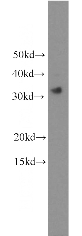 PC-3 cells were subjected to SDS PAGE followed by western blot with Catalog No:116120(TICAM2 antibody) at dilution of 1:500