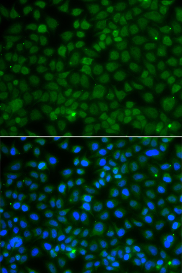 Immunofluorescence - WDR45 Polyclonal Antibody 