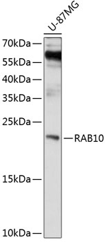 Western blot - RAB10 Polyclonal Antibody 