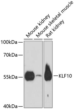 Western blot - KLF10 Polyclonal Antibody 