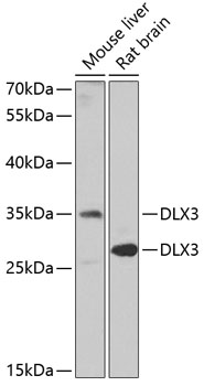 Western blot - DLX3 Polyclonal Antibody 