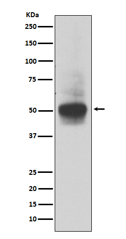 Western blot analysis of RUNX1/RUNX2/RUNX3 expression in MOLT4 cell lysate.