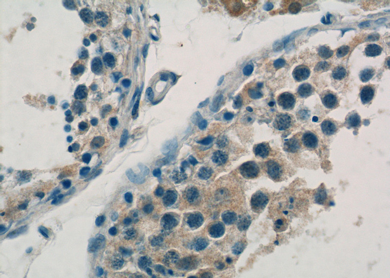Immunohistochemistry of paraffin-embedded human testis tissue slide using Catalog No:109870(DAX-1 Antibody) at dilution of 1:50 (under 40x lens)