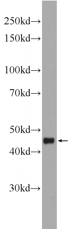 Recombinant protein were subjected to SDS PAGE followed by western blot with Catalog No:111654(IL10 Antibody) at dilution of 1:1000