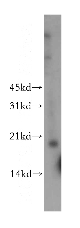 human heart tissue were subjected to SDS PAGE followed by western blot with Catalog No:116215(TPRKB antibody) at dilution of 1:300