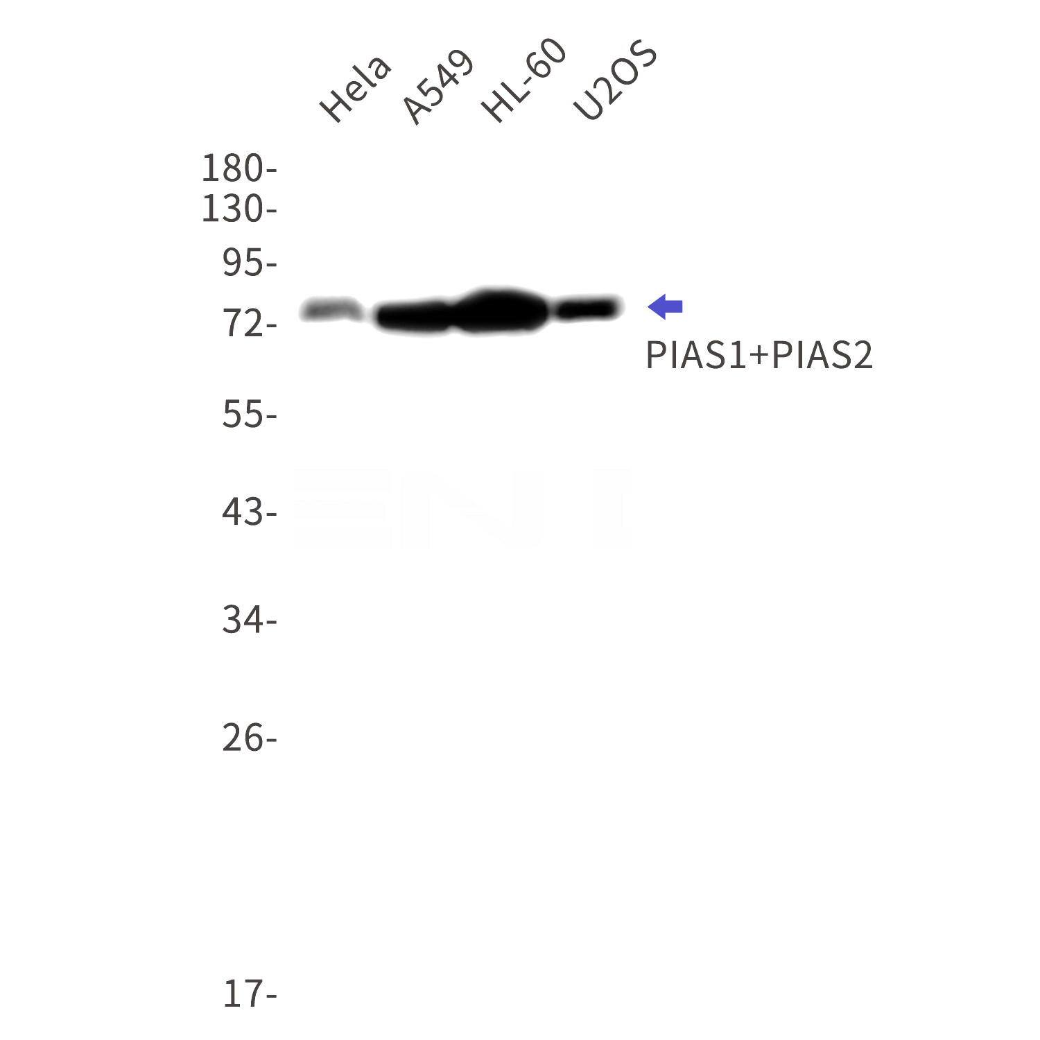 Western blot detection of PIAS1+PIAS2 in Hela,A549,HL-60,U2OS cell lysates using PIAS1+PIAS2 Rabbit mAb(1:1000 diluted).Observed band size:76kDa.