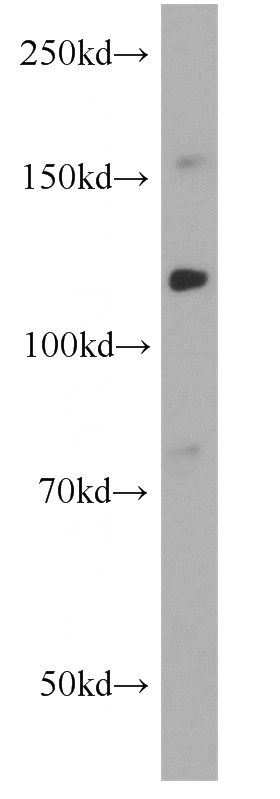 HL-60 cells were subjected to SDS PAGE followed by western blot with Catalog No:109030(CD34 antibody) at dilution of 1:500