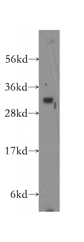 mouse brain tissue were subjected to SDS PAGE followed by western blot with Catalog No:109452(GJB1 antibody) at dilution of 1:300