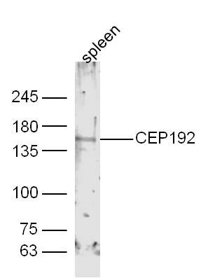 Fig2: Sample:; Spleen (Mouse) Lysate at 40 ug; Primary: Anti-CEP192 at 1/300 dilution; Secondary: IRDye800CW Goat Anti-Rabbit IgG at 1/20000 dilution; Predicted band size: 213 kD; Observed band size: 150 kD