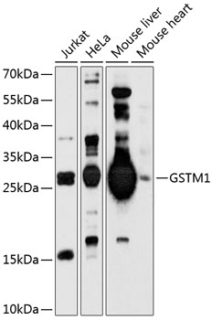 Western blot - GSTM1 Polyclonal Antibody 
