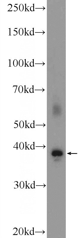 fetal human brain tissue were subjected to SDS PAGE followed by western blot with Catalog No:110714(FOXR1 Antibody) at dilution of 1:600