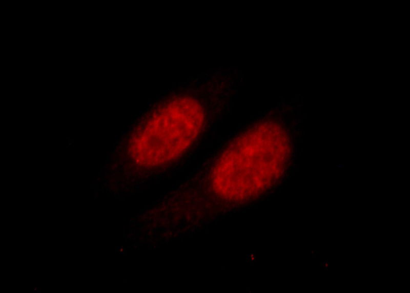 Immunofluorescent analysis of HepG2 cells, using HNRNPK antibody Catalog No:111509 at 1:25 dilution and Rhodamine-labeled goat anti-rabbit IgG (red).