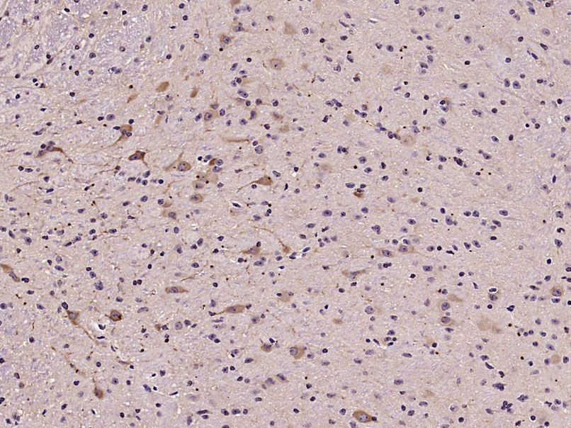 Fig2: Paraformaldehyde-fixed, paraffin embedded (Mouse brain); Antigen retrieval by microwave in sodium citrate buffer (pH6.0) ; Block endogenous peroxidase by 3% hydrogen peroxide for 30 minutes; Blocking buffer (3% BSA) at RT for 30min; Antibody incubation with (Sema3A) Polyclonal Antibody, Unconjugated at 1:400 overnight at 4℃, followed by conjugation to the secondary antibody (labeled with HRP)and DAB staining.