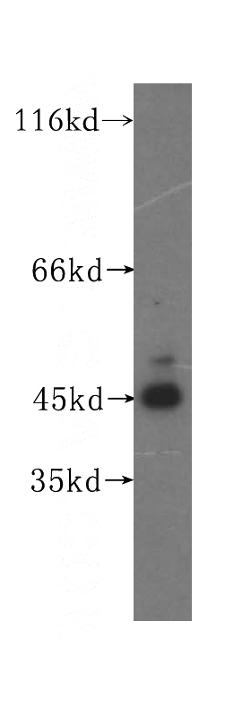 HepG2 cells were subjected to SDS PAGE followed by western blot with Catalog No:111446(HPD antibody) at dilution of 1:300