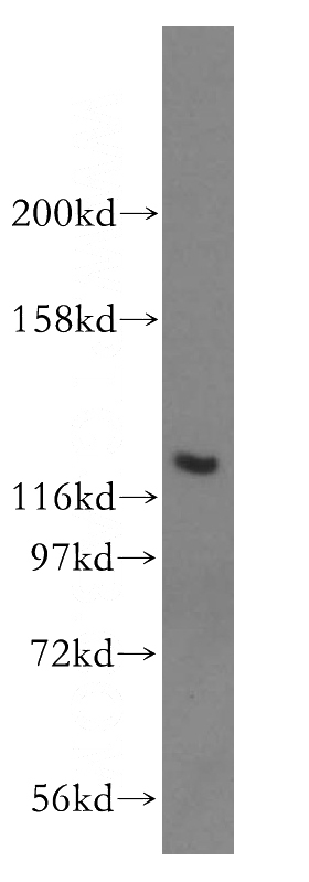 mouse spleen tissue were subjected to SDS PAGE followed by western blot with Catalog No:107825(ACAD10 antibody) at dilution of 1:300