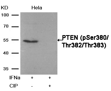 Western blot analysis of extracts from Hela cells, treated with IFNa or calf intestinal phosphatase (CIP), using PTEN (Phospho-Ser380/Thr382/Thr383) Antibody .