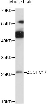 Western blot - ZCCHC17 Polyclonal Antibody 
