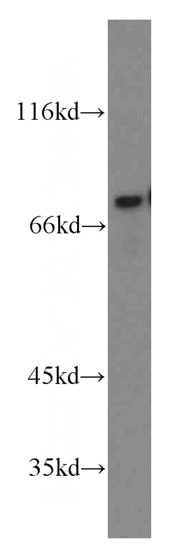 PC-3 cells were subjected to SDS PAGE followed by western blot with Catalog No:113445(NR4A1 antibody) at dilution of 1:100