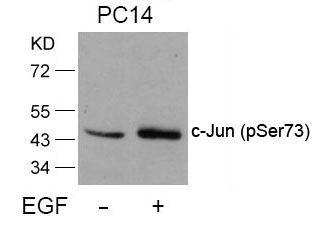 Western blot analysis of extracts from PC14 cells untreated or treated with EGF using c-Jun (Phospho-Ser73) Antibody .