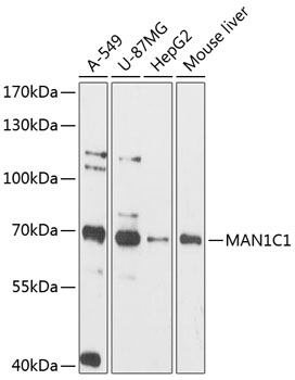 Western blot - MAN1C1 Polyclonal Antibody 