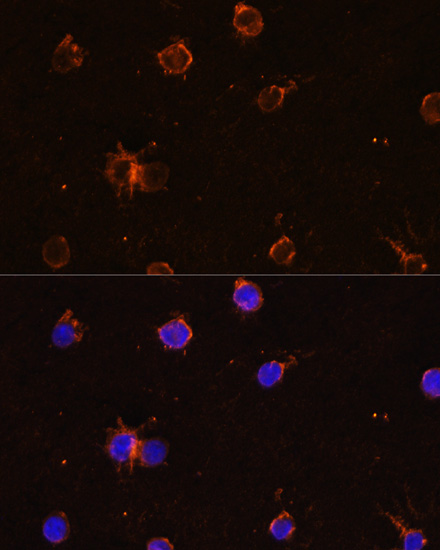 Immunofluorescence - CD11B Polyclonal Antibody 