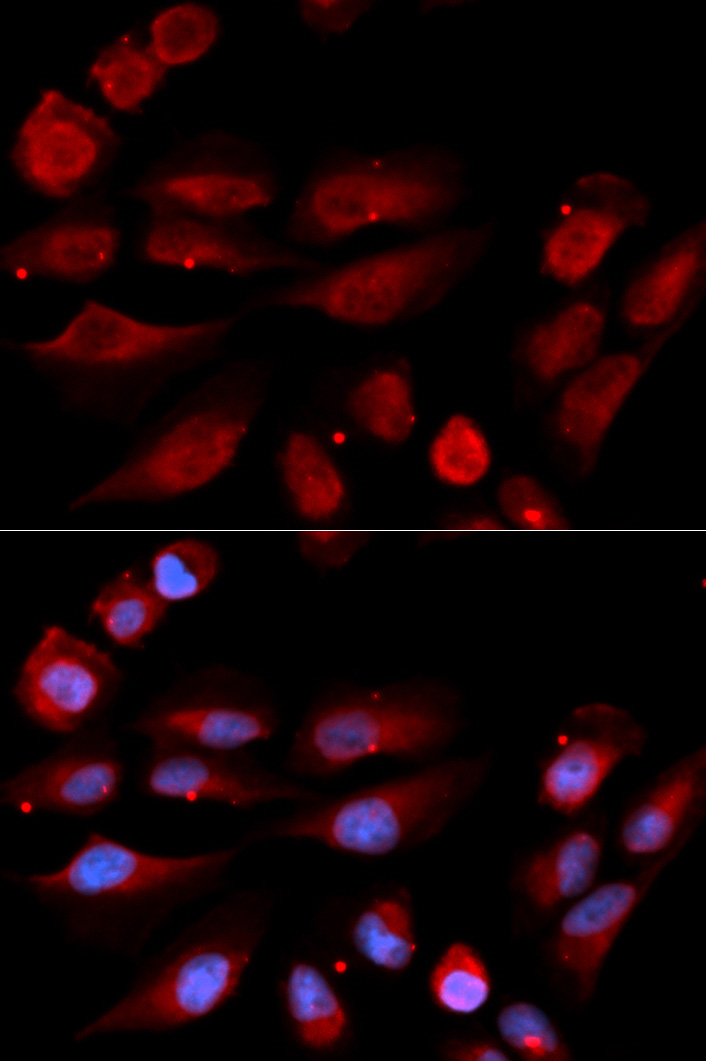 Immunofluorescence - 53BP1 Polyclonal Antibody 