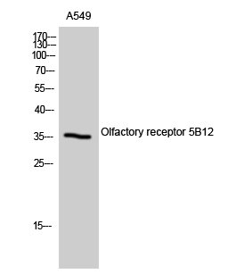 Fig1:; Western Blot analysis of A549 cells using Olfactory receptor 5B12 Polyclonal Antibody