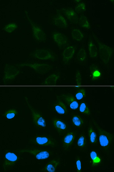 Immunofluorescence - UGT1A9 Polyclonal Antibody 