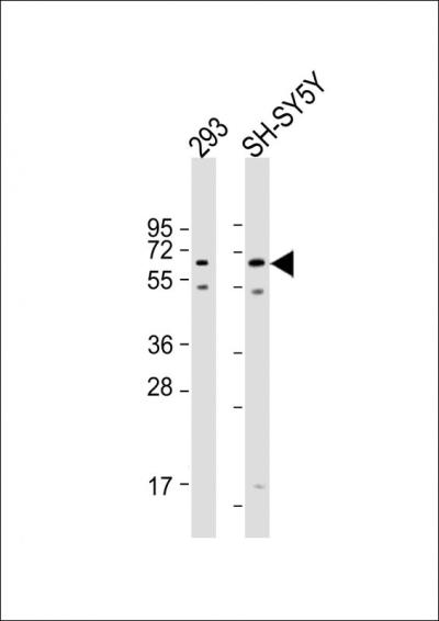 All lanes: Anti-AMH Antibody (Center) at 1:2000 dilutionnLane 1: 293 whole cell lysatenLane 2: SH-SY5Y whole cell lysatennLysates/proteins at 20 u03bcg per lane. nnSecondarynGoat Anti-Rabbit IgG,  (H+L), Peroxidase conjugated at 1/10000 dilution. nnPredicted band size: 59 kDannBlocking/Dilution buffer: 5% NFDM/TBST.