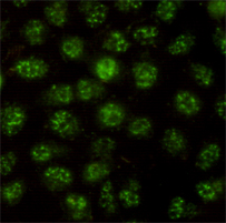 Immunocytochemistry staining of HeLa cells using STAT3 rabbit pAb (dilution 1:100).